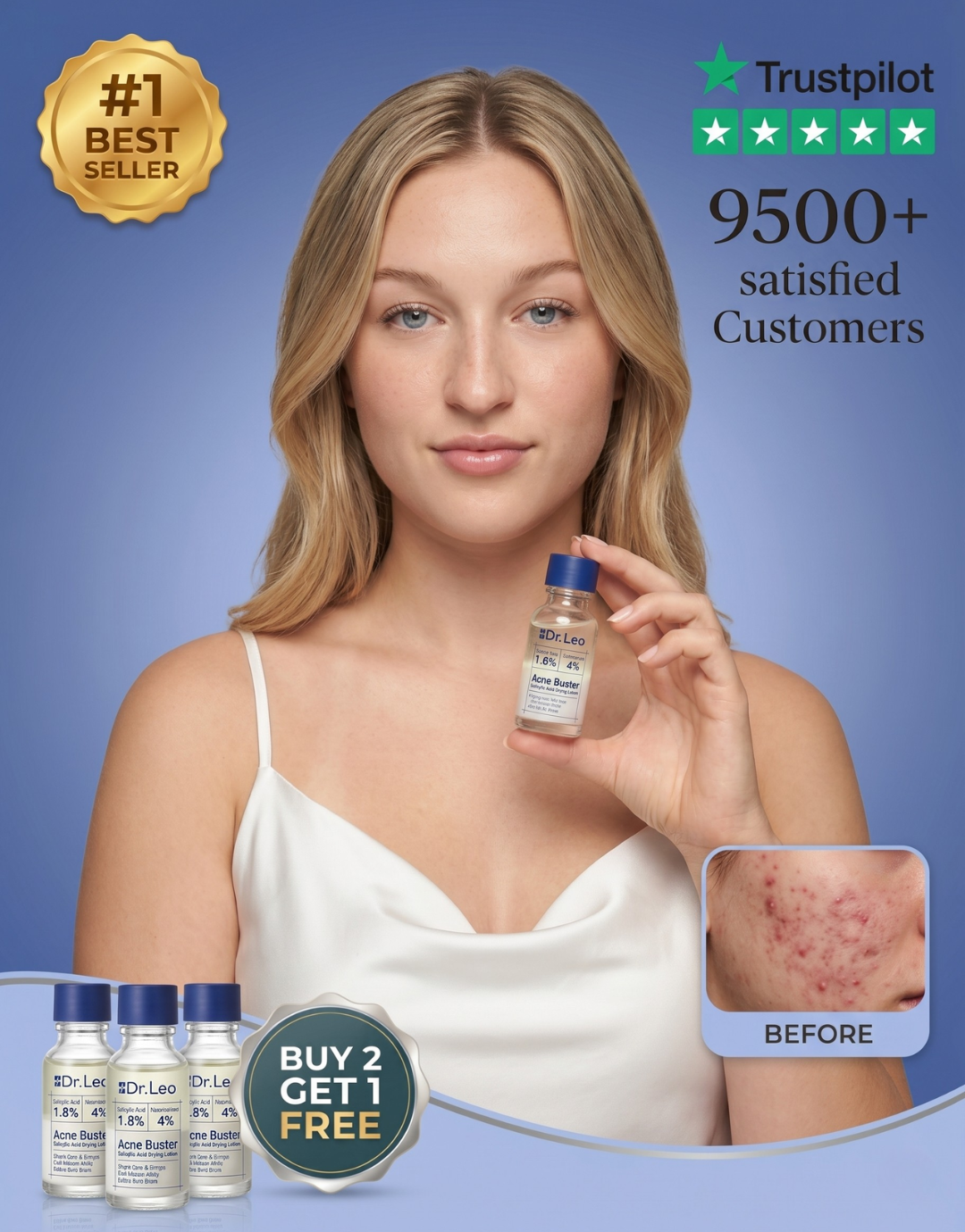 Shrink Pimples In 24 Hours